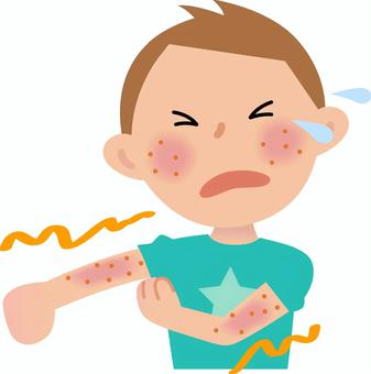 耳つぼで健康に【アトピー性皮膚炎】