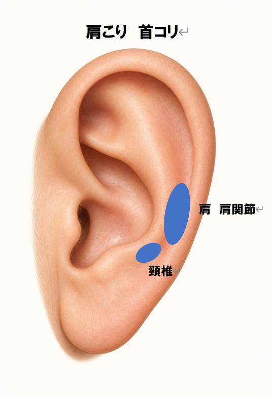 肩こり・首コリで注目される耳つぼの位置（肩・肩関節・頸椎）